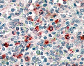 CD14 Antibody