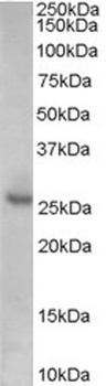 CD14 Antibody