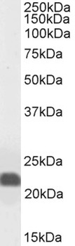 Caveolin-1 Antibody