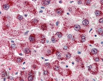 CAT Antibody