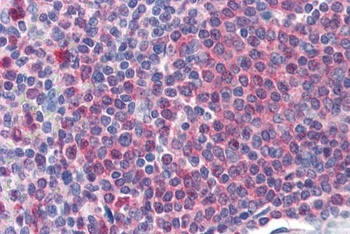 CAT Antibody