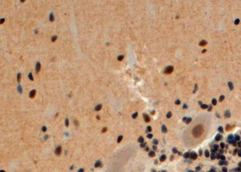 ARRB2 Antibody