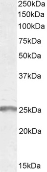 ARRB2 Antibody