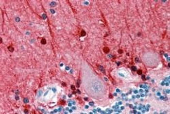 AMPH Antibody