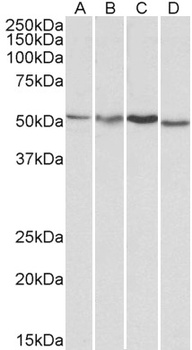 AKT3 Antibody