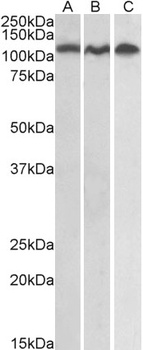 ADAM17 Antibody