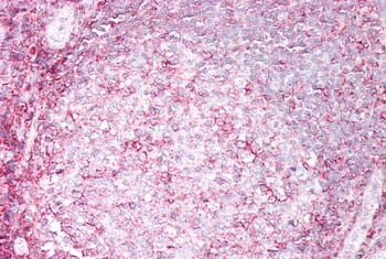 dUTPase / DUT Antibody