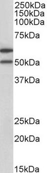 dUTPase / DUT Antibody