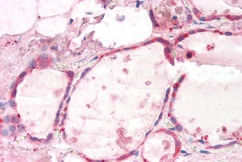 IP6K3 Antibody