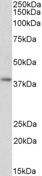 CSNK2B Antibody