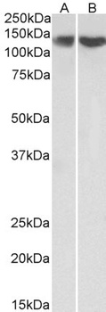 IL17C Antibody
