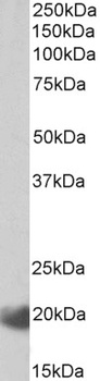 BOD1L Antibody