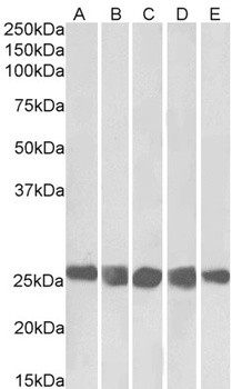 SRRT / ARS2 Antibody