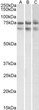 cardiac troponin T Antibody