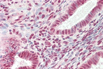 ICAM1 Antibody