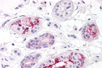 LYVE1 Antibody