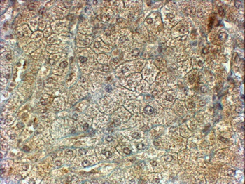 IL3RA/CD123 Antibody