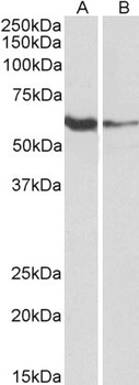 FCRL1 Antibody