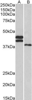 CTNNB1/catenin beta-1 Antibody