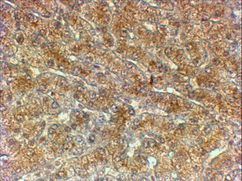 CTNNB1/catenin beta-1 Antibody