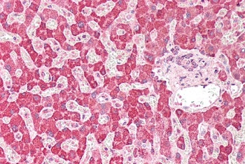CD4 Antibody
