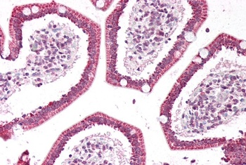 CD4 Antibody