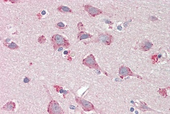 Vimentin Antibody