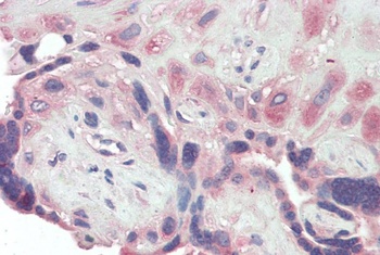 Vimentin Antibody