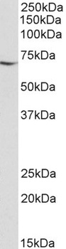Vimentin Antibody