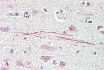 APOA1 Antibody