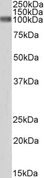 BMP1 Antibody