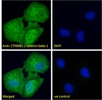 BMP1 Antibody