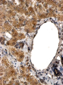 CCAR2 / DBC1 Antibody