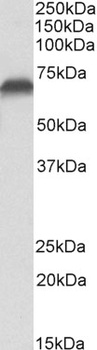 CCAR2 / DBC1 Antibody