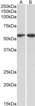 CD3-ZETA / CD247 Antibody