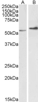 Acrosin light chain Antibody