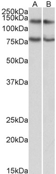 Alfy/WDFY3 Antibody