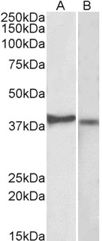 NME1 Antibody