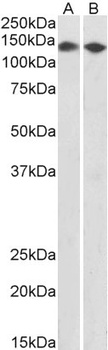 LCP1/plastin-2 Antibody