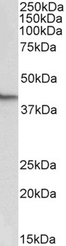 SP140 Antibody