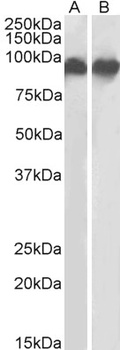 MSI2 / musashi-2 Antibody