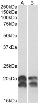CD27 Antibody