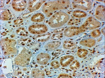 cytochrome P450 1A1 Antibody