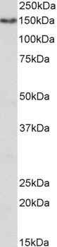 CLEC12A/MICL Antibody