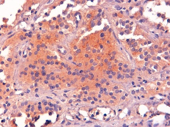 POMC Antibody