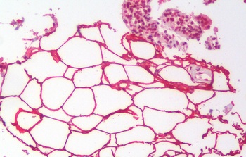 BMI1 Antibody