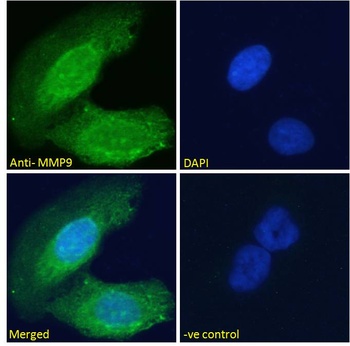 ABCG2/BCRP Antibody