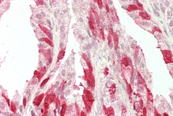 ERBB2/HER2 Antibody