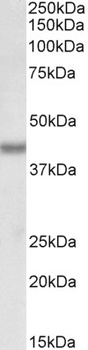 alpha-fetoprotein Antibody