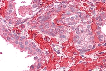 TERF1/TRF1 Antibody